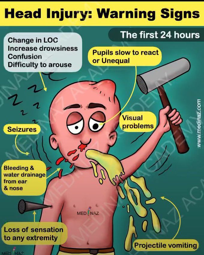 Head injury warning signs