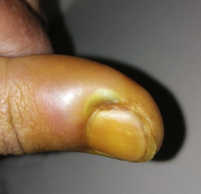 Diagnose