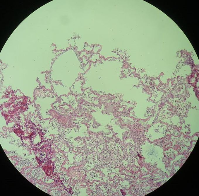 Diagnosis?