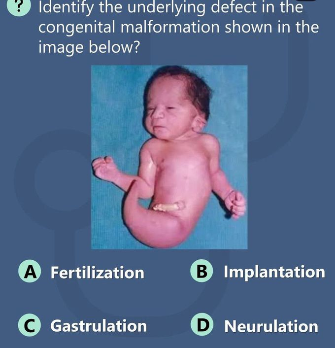 Identify the Condition