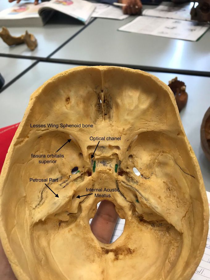 Internal view cranium anatomy part 2