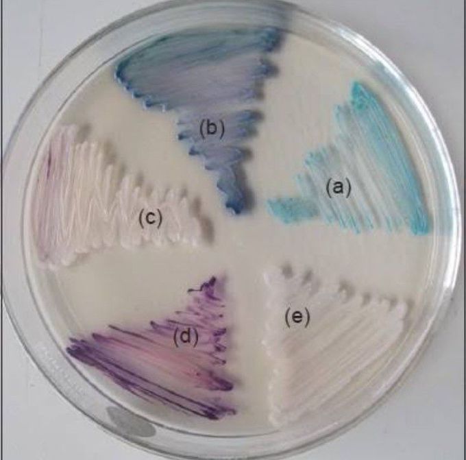 CHROMagar .Can you tell the use of the agar???