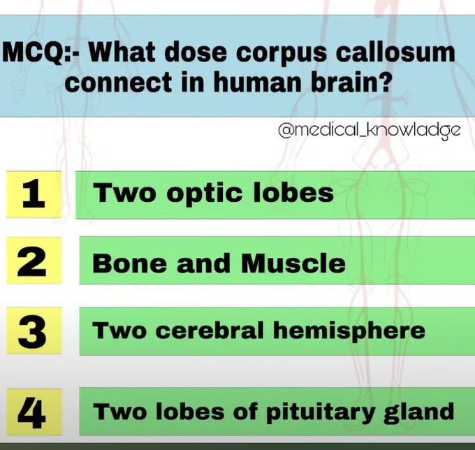 Corpus Callosum connects which to structures?