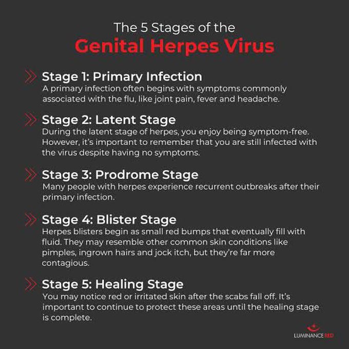 Stages of Genital Herpes Virus