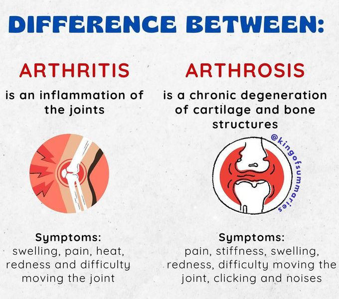 Arthritis Vs Arthrosis