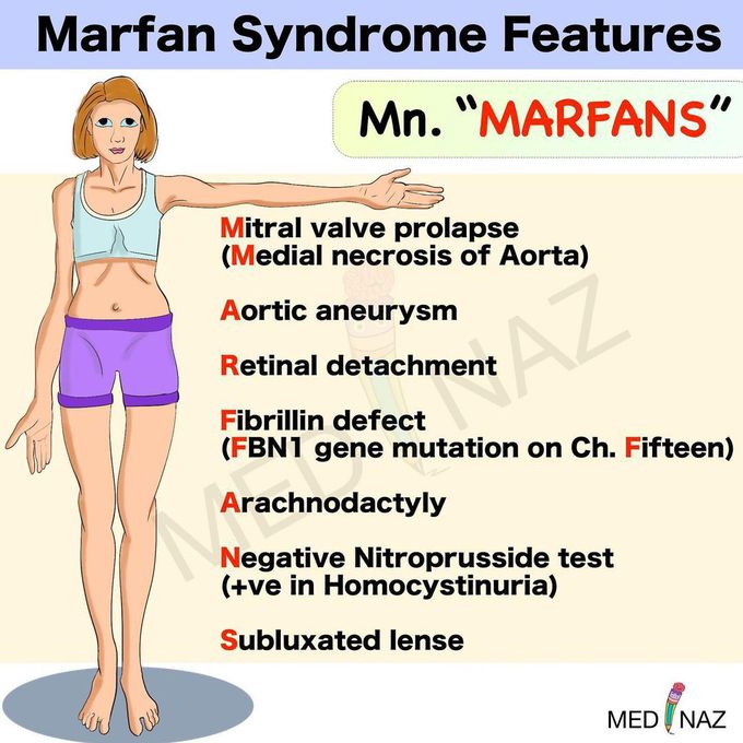 Marfan syndrome