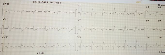 Diagnosis?