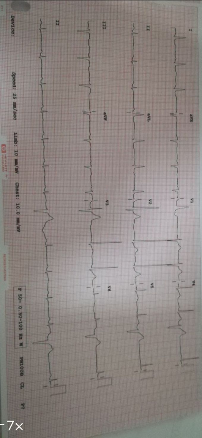 What's your diagnosis?