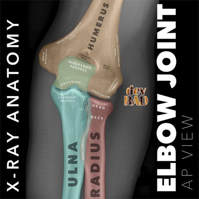AP Elbow Radiograph Anatomy