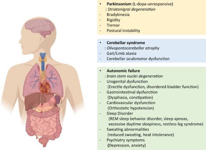 Multiple System Atrophy