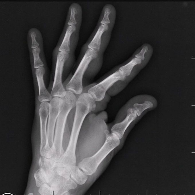 Diagnosis?