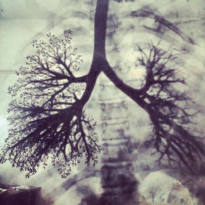 Tree of life