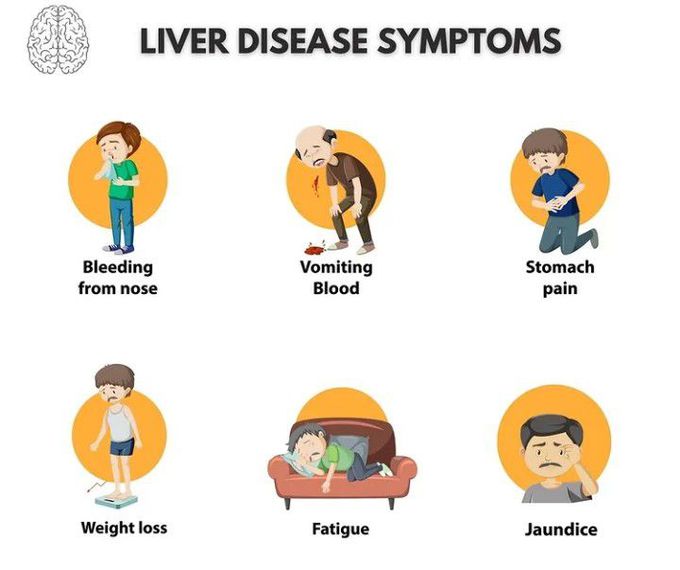 Liver disease symptoms