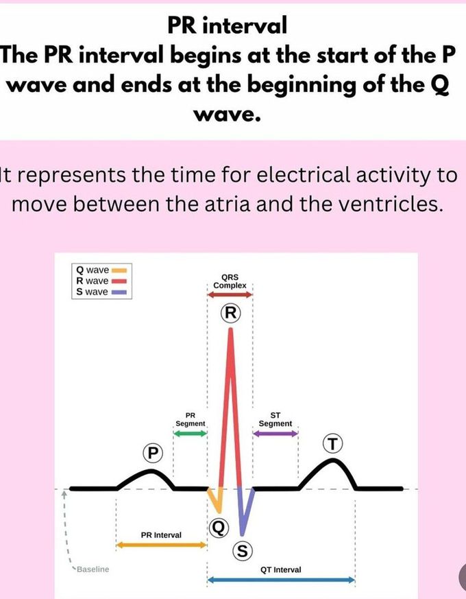 ECG Basics II