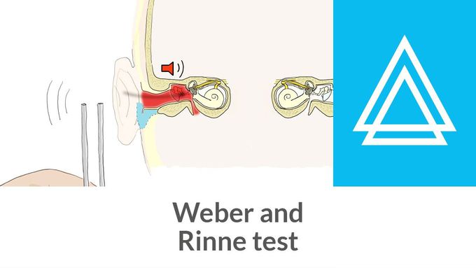 Weber and Rinne test - Clinical examination |
