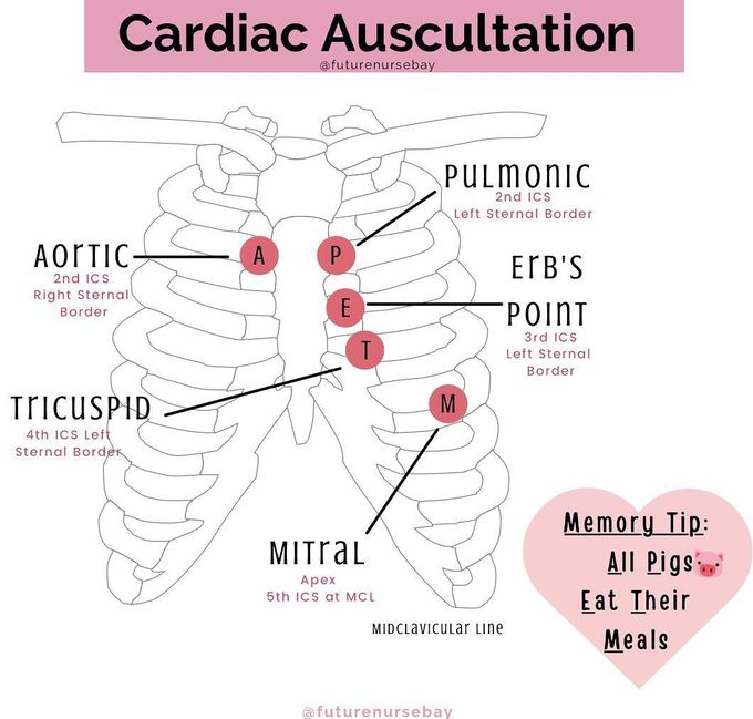 Cardiac Auscultation