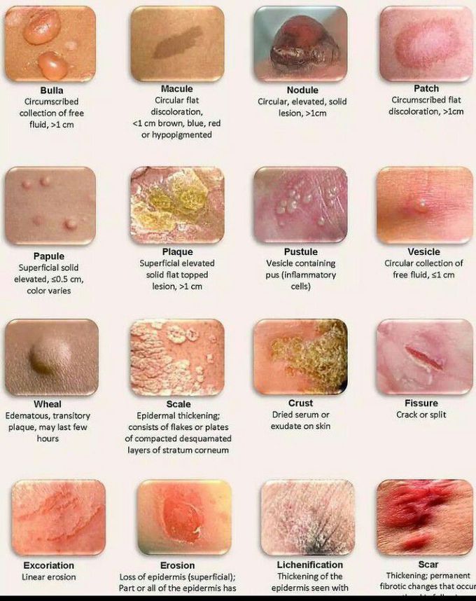 Different skin presentations