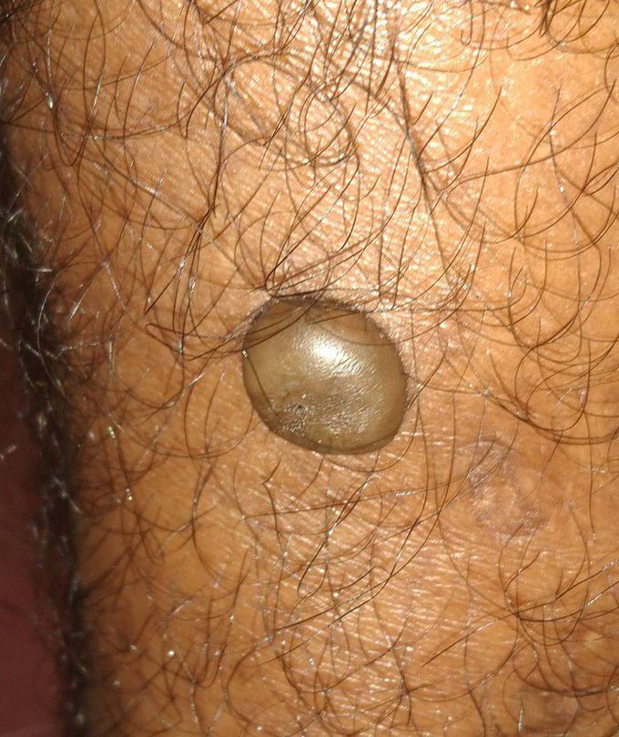 What's the diagnosis here?