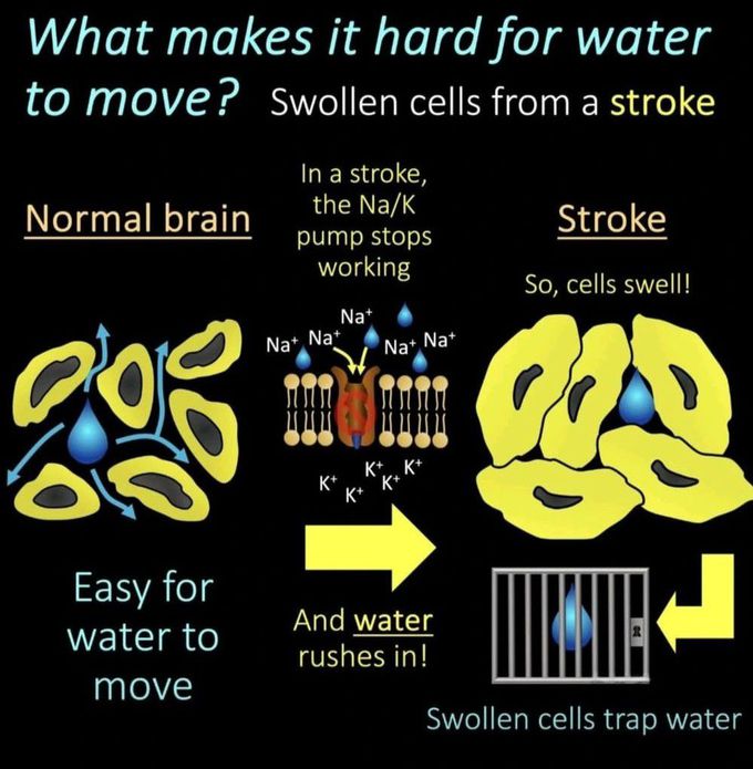 How to Read MRI VIII