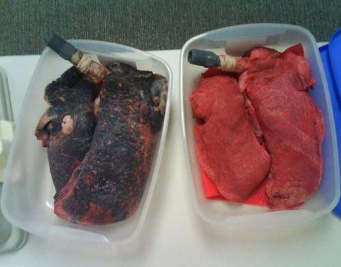 Smoker vs non smoker