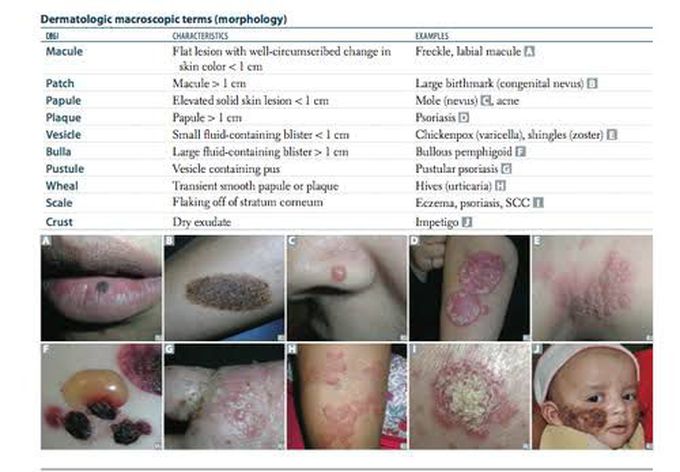 Dermatological Macroscopic Terms