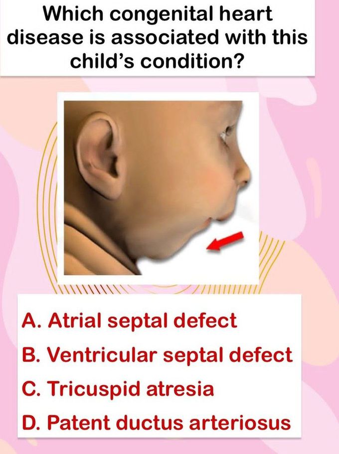 Identify the Condition