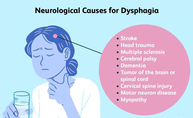 Neurological cause for Dysphagia