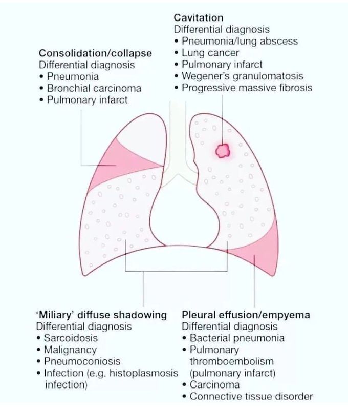 Lung Pathologies
