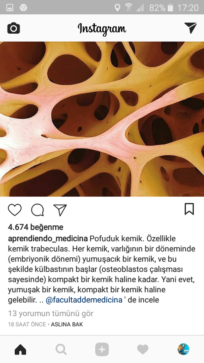 Osteoporosis
