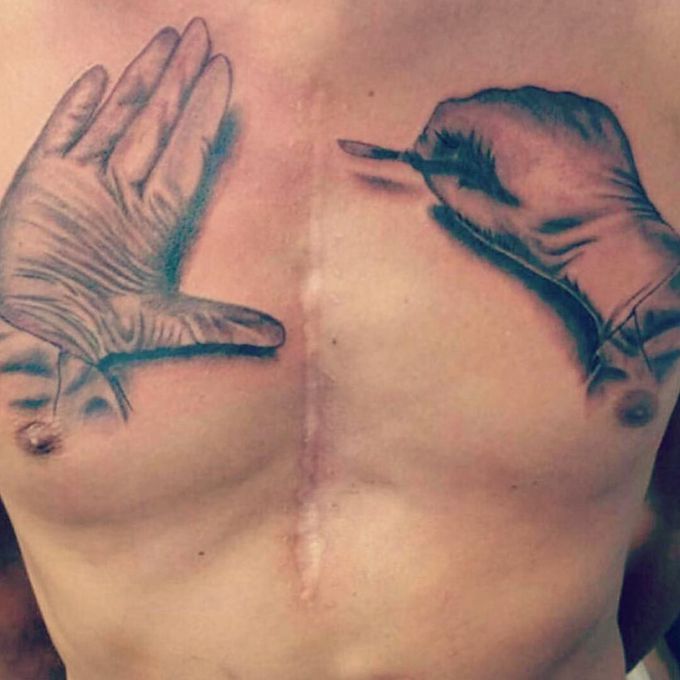 A brilliant idea to make a great tattoo out of a surgical - MEDizzy