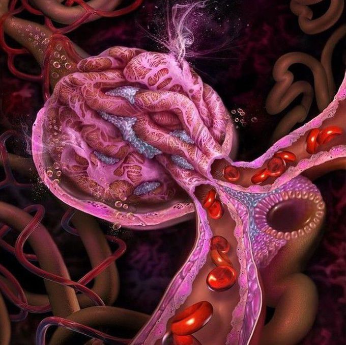 Glomerulus