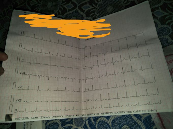 Diagnosis?? Plz