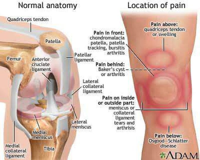 Suspected diagnosis by pain area