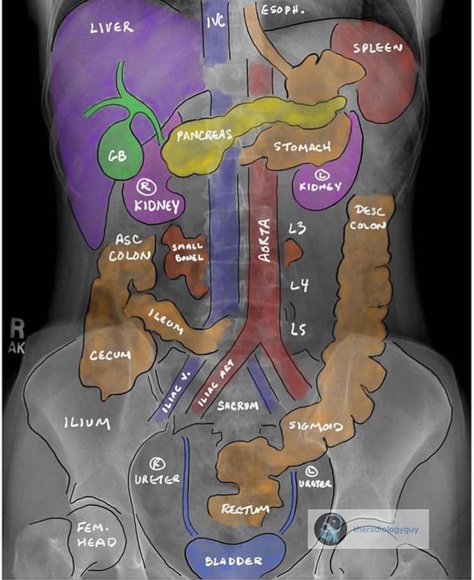 The abdomen x-ray