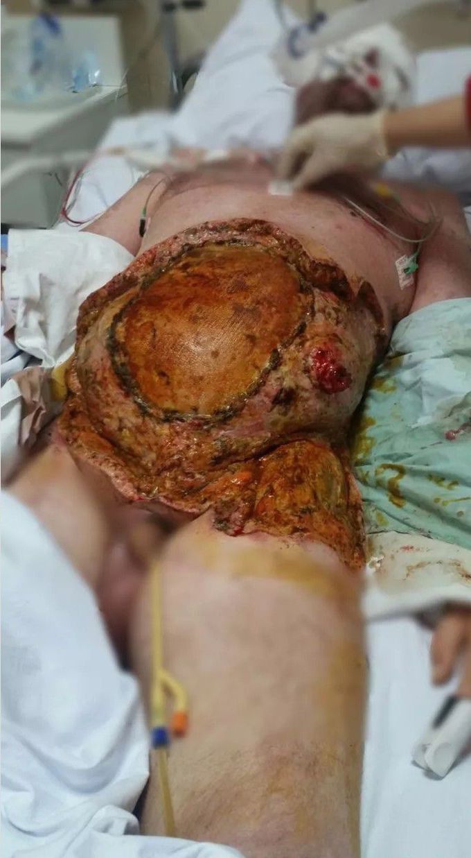 general trauma surgery