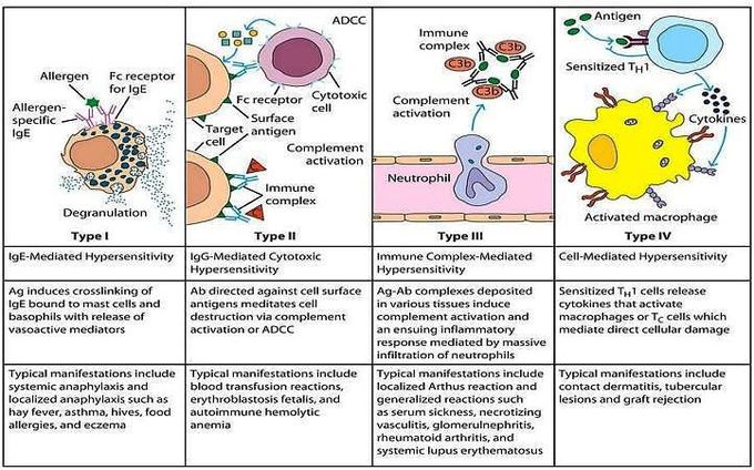 Hypersensitivity