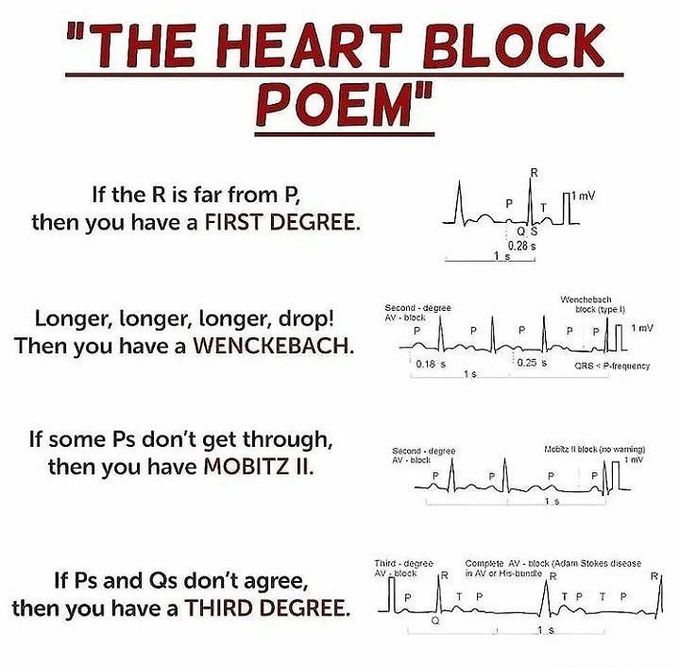 Heart block Poem