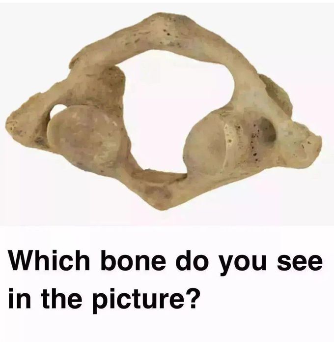 Identify the Bone