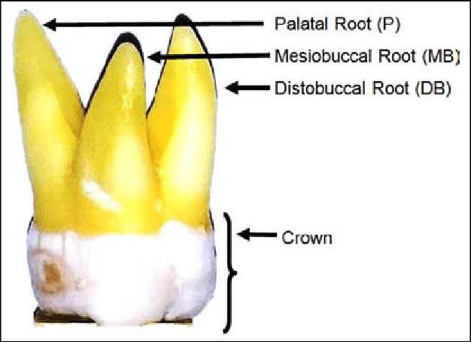 Anatomy of upper first molar roots