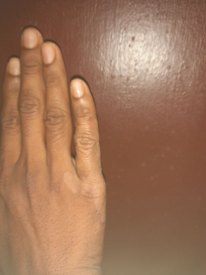 what is the diagnosis and treatment?