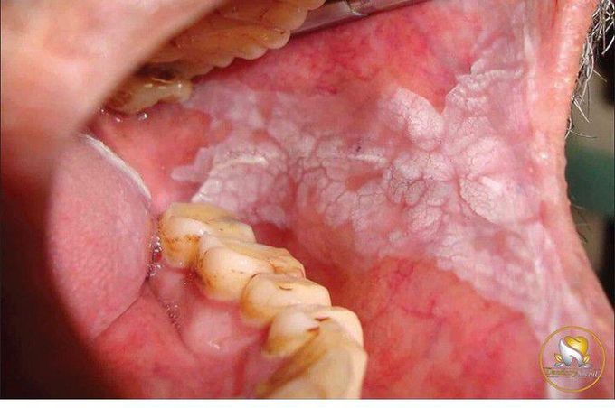 Whats your diagnosis?