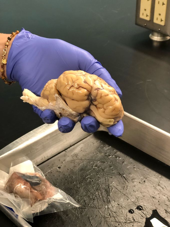 Sheet Brain