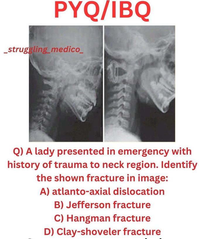 Identify the Fracture