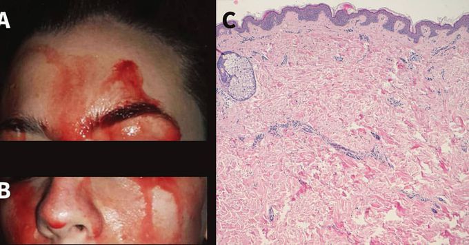 Amazing medical case 