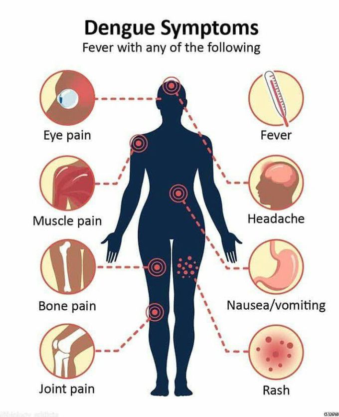 Dengue Symptoms