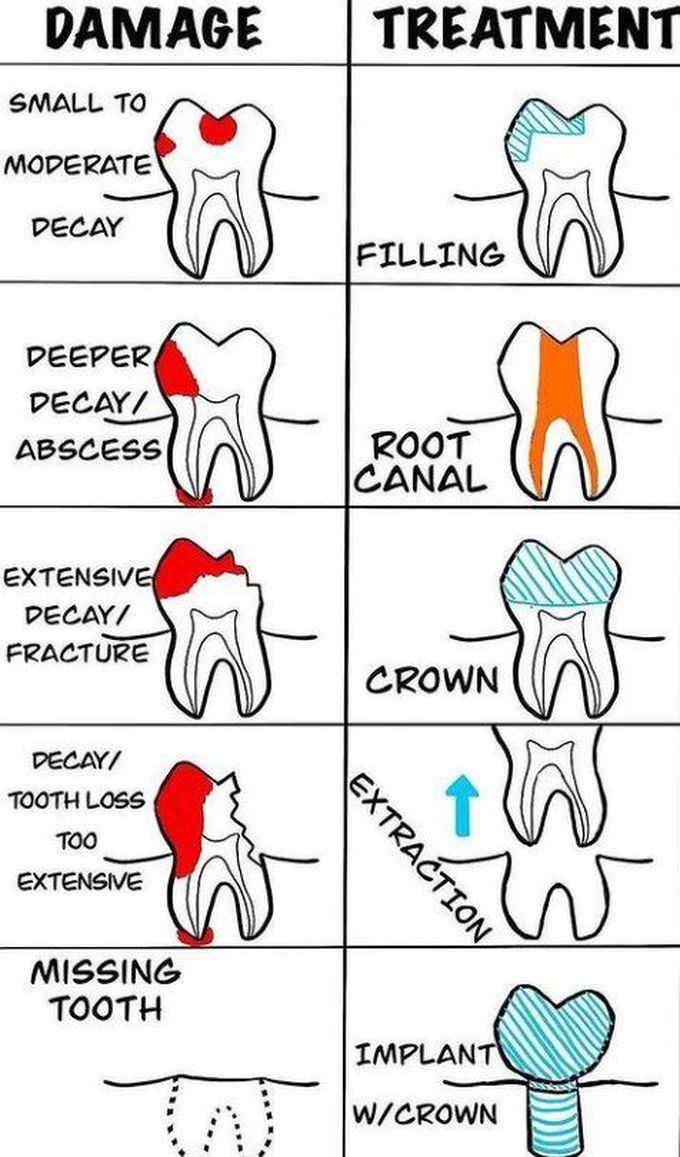 Common dental treatment