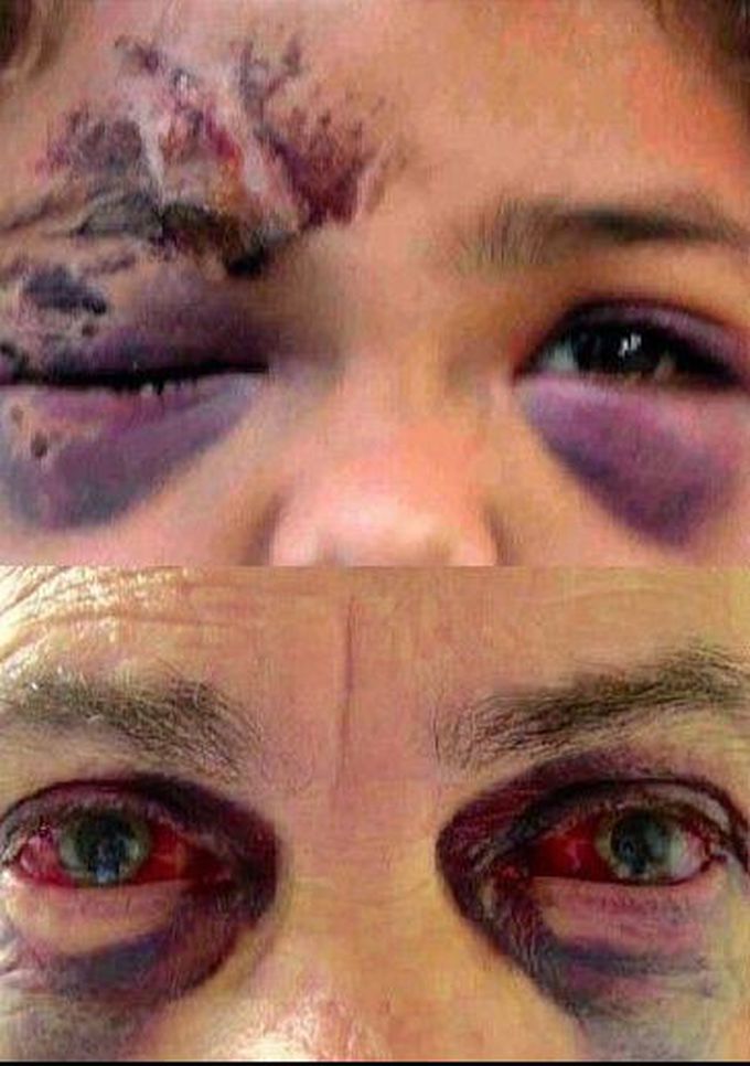 What is the of this condition?? And what’s the causes???