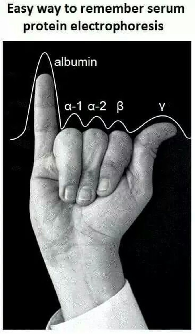 Easy way to remember serum protein electrophoresis