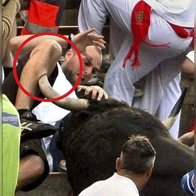 A bulls horn gorges up into a mans leg! 