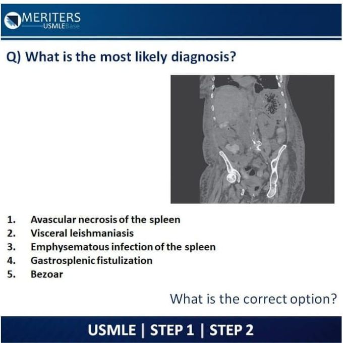 Most likely diagnosis of the presented disease